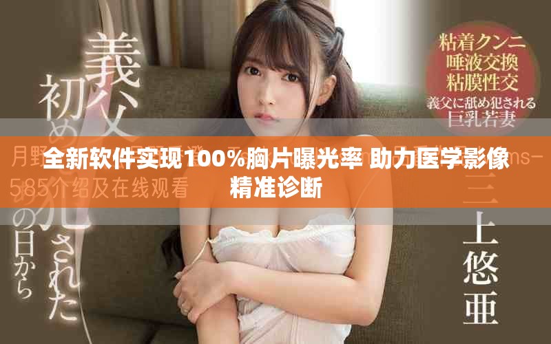 全新软件实现100%胸片曝光率 助力医学影像精准诊断